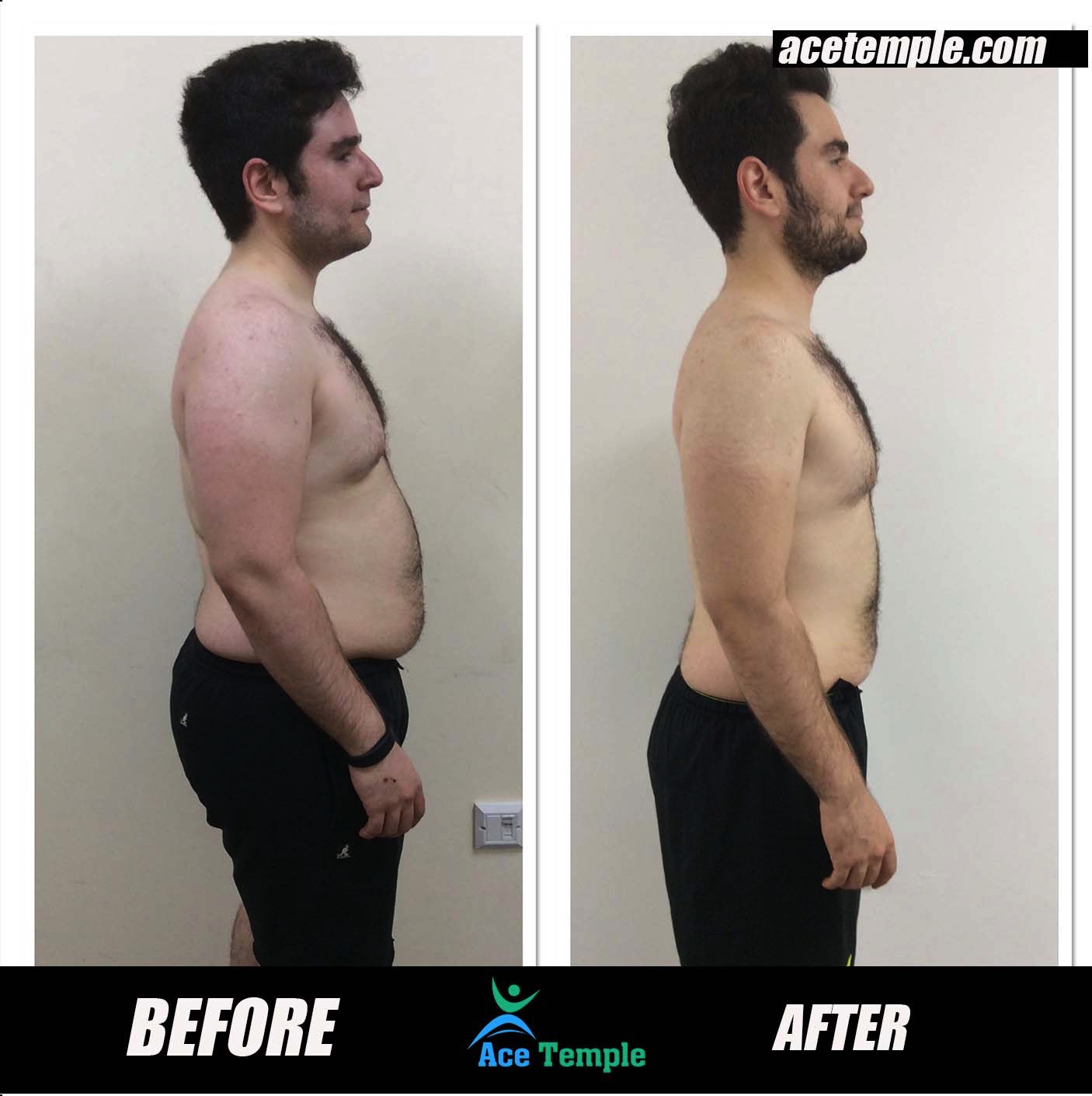 Transformation 2